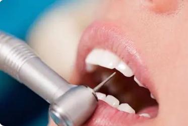 牙髓切断术的操作流程简述