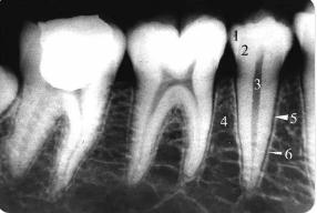 牙釉质、牙本质和牙骨质的正常X线影像